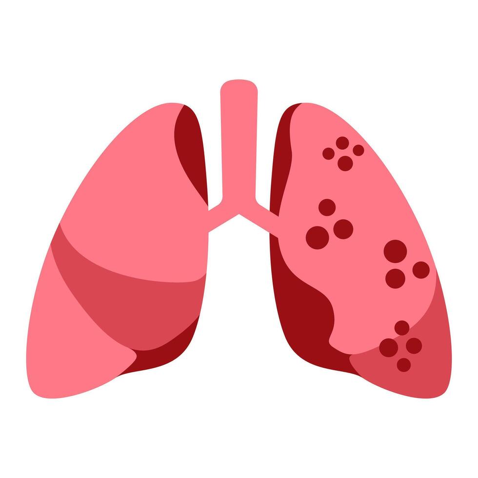 flat tuberculosis lung disease illustration vector