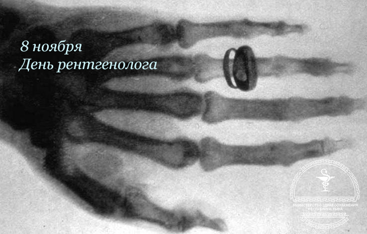 первая в истории рентген фотография МЗРТ